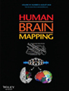 Human Brain Mapping期刊封面
